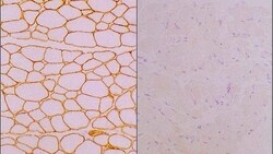 Leica Biosystems 1ml NCL-MEROSIN, Quantity: Each of 1