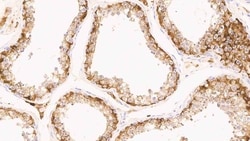 Leica Biosystems 1ml NCL-L-InhibinA, Quantity: Each of 1