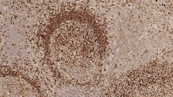 Leica Biosystems 1ml NCL-L-IgM, Quantity: Each of 1