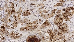 Leica Biosystems 1ml NCL-L-GCDFP15, Quantity: Each of 1