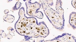 Leica Biosystems 1ml NCL-L-FXIIIa, Quantity: Each of 1