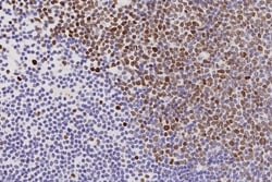 Leica Biosystems 1ml NCL-L-EZH2, Quantity: Each of 1