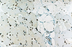 Leica Biosystems 1ml NCL-EMERIN, Quantity: Each of 1