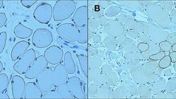 Leica Biosystems 1ml NCL-DYSB, Quantity: Each of 1