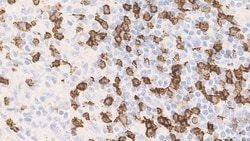Leica Biosystems 1ml NCL-L-CD8-4B11, Quantity: Each of 1