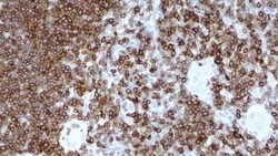 Leica Biosystems 1ml NCL-L-CD7-580, Quantity: Each of 1