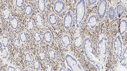Leica Biosystems 1ml NCL-L-CD56-504, Quantity: Each of 1
