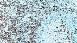 Leica Biosystems 1ml NCL-L-CD5-4C7, Quantity: Each of 1