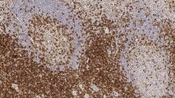 Leica Biosystems 1ml NCL-L-CD4-368, Quantity: Each of 1