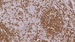 Leica Biosystems 1ml NCL-L-CD20-L26, Quantity: Each of 1
