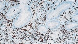 Leica Biosystems 1ml NCL-L-CD16, Quantity: Each of 1