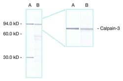 Leica Biosystems 2.5ml NCL-CALP-12A2, Quantity: Each of 1