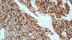 Leica Biosystems 1ml NCL-L-Calcitonin, Quantity: Each of 1