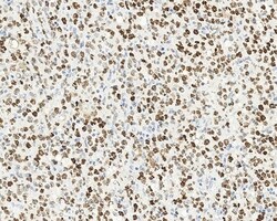 Leica Biosystems 1ml NCL-L-Bcl-6-564, Quantity: Each of 1