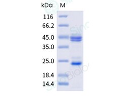 Sino Biological Recombinant Mouse IL-23 Protein (His Tag), HPLC-verified,