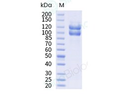 Sino Biological Human Integrin alpha 2b beta 3 Heterodimer Protein (I874S,