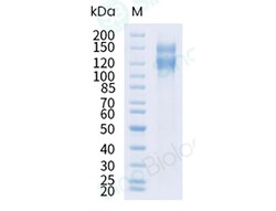 Sino Biological Recombinant Human Integrin alpha V beta 1 Protein (Flag