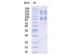 Sino Biological Recombinant Human Integrin alpha V beta 5 Protein (Flag