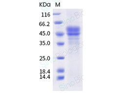 Sino Biological Recombinant Mouse CD3D & CD3E Heterodimer Protein (ECD,
