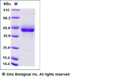 Sino Biological Recombinant Cynomolgus CD3E & CD3G Heterodimer Protein