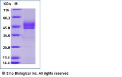 Sino Biological Recombinant Human CD3E & CD3G Heterodimer Protein (C-Llama-Fc),