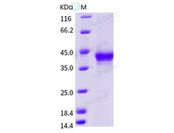 Sino Biological Recombinant Rhesus CD3E & CD3G Heterodimer Protein (hFc