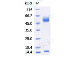 Sino Biological Recombinant Mouse FCGRT & B2M Heterodimer Protein (His
