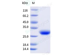 Sino Biological Recombinant Human CD8A & CD8B Heterodimer Protein (Flag