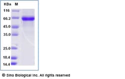 Sino Biological Recombinant Human IL-23 Protein (His & AVI Tag), Biotinylated,