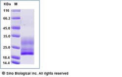 Sino Biological Recombinant Human CD3D & CD3E Heterodimer Protein (Flag
