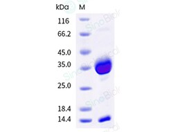Sino Biological Recombinant Cynomolgus FCGRT & B2M Heterodimer Protein