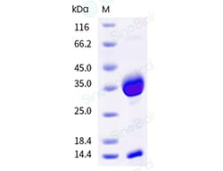 Sino Biological Recombinant Cynomolgus FCGRT & B2M Heterodimer Protein