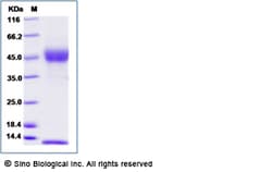 Sino Biological Recombinant Rat FCGRT & B2M Heterodimer Protein (His Tag),