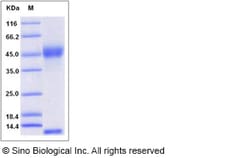 Sino Biological Recombinant Rat FCGRT & B2M Heterodimer Protein (His Tag),