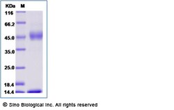 Sino Biological Recombinant Mouse FCGRT & B2M Heterodimer Protein (His