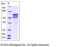 Sino Biological Recombinant Mouse IL-12 Protein (His & hFc Tag), Quantity: