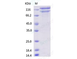 Sino Biological Recombinant Human Integrin alpha X beta 2 Protein (His