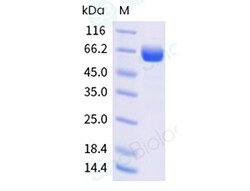Sino Biological Recombinant Rhesus Alkaline phosphatase/APLI Protein (His
