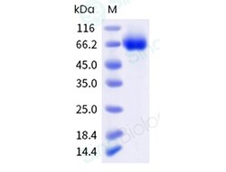 Sino Biological Recombinant Cynomolgus CD70/CD27 Ligand Protein (ECD, His