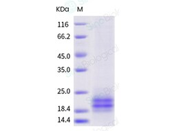Sino Biological Recombinant Cynomolgus TACI Protein (His Tag), Quantity: