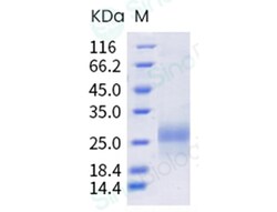Sino Biological Recombinant Cynomolgus, Rhesus PVRIG Protein (His Tag),