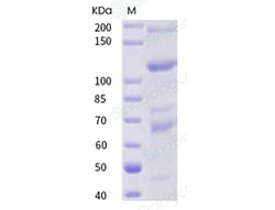 Sino Biological Recombinant Cynomolgus Complement component 3 Protein (His