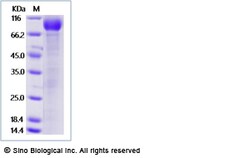 Sino Biological Recombinant Cynomolgus IL1RAP/IL-1RAcP Protein (ECD, hFc