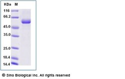 Sino Biological Recombinant Cynomolgus Siglec-15 Protein (ECD, hFc Tag),
