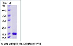 Sino Biological Recombinant Cynomolgus IL-11 Protein, Quantity: Each of
