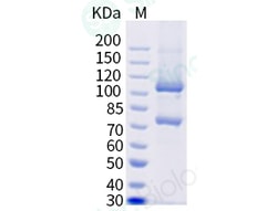 Sino Biological Recombinant Cynomolgus Complement C5 Protein (His Tag),