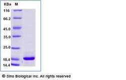 Sino Biological Recombinant Cynomolgus IL-33 Protein, Quantity: Each of