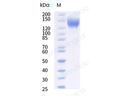 Sino Biological Recombinant Cynomolgus VEGFR2/KDR Protein (ECD, His Tag),