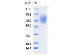 Sino Biological Recombinant Cynomolgus, Rhesus B7-H4 Protein (His Tag),