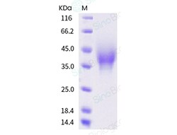 Sino Biological Recombinant Cynomolgus CD30/TNFRSF8 Protein (His Tag),